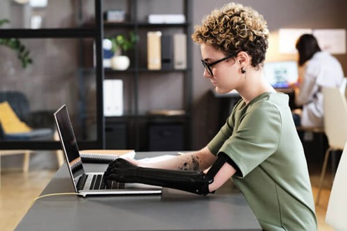 A disabled employee using a laptop